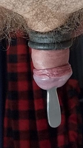 Probe buried in the depths of my sgeg