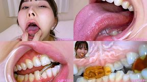 Kana Yura - Special Project - Even More Revealing Special Inside Oral Observation & Oral Fetish Play - MOV 1080p