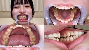 Wakaba Tsukimi - Watching Inside mouth of Japanese cute girl - MOV