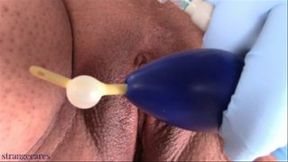 wetting with catheter in urethral plug