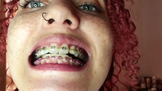 Freckled Redhead girl gives you a sweet JOI while shows her braces - JOI BRACES FETISH