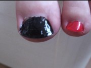 UEFA Euro 2016: Left Toenails