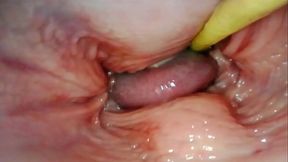 AMAZING INTERNAL POV  CAMERA INSIDE HER PUSSY WHILE I FILL HER WITH CUM
