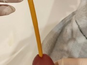 removal of a urological catheter