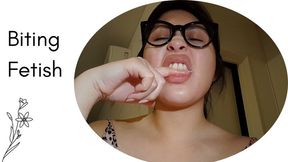 Biting my fingers again