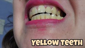 Brushing My Yellow Crooked Teeth After Days Without Cleaning – Real Oral Hygiene Fetish While Topless, Dirty Mouth Transformation
