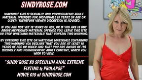 Sindy Rose XO speculum anal extreme fisting &amp_ prolapse