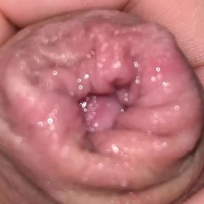 Foreskin up close with piss