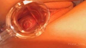 Speculum Cervix Exploration