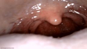 yawning uvula endoscopy (1080 wmv)