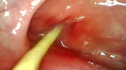 POV Ass fuck, My Raging Hard-On Drills Deep, Blasts Jizz Right In Her Guts