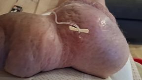 Extreme Fillings Inside My Siliconemeat