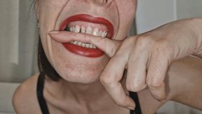 The Terrifying Sound of My Teeth