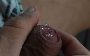 Boy with a Red Dick About to Explode