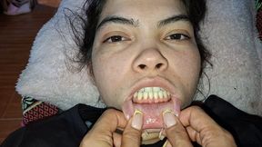 Lip Stretching Game With Noises