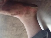 Locked chub on usual barefoot walk around lakeside