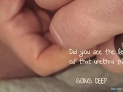 Huge Urethra Cock Ring Insert