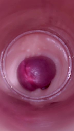 Female Insemination - Internal Camera Captures Deep Male Ejaculation