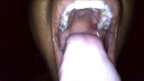 Lexi Endoscope Mouth Tour