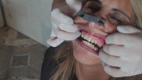 Laly's Sharp Teeth (HD MP4)