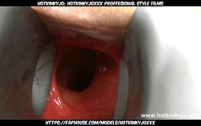 Sexy Blonde Nurse with Huge Speculum in Her Ass by Hotkinkyjo