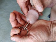 Urethral sounding