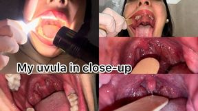 Exploring my uvula