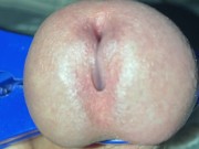 Thumbs up if you bite, thumbs down if you feel bad for the head