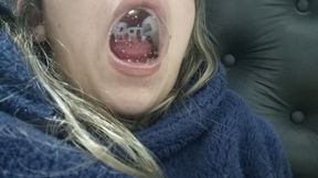 My big saliva balloons