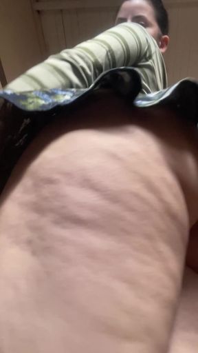 Close-up of cellulite on thigh