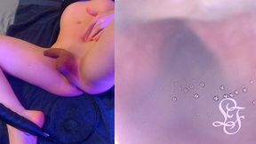 deepest anal exploration ever!