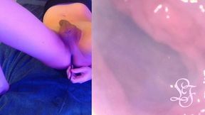 deepest anal exploration ever!