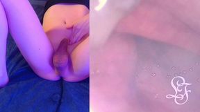 deepest anal exploration ever!