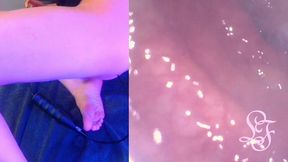 deepest anal exploration ever!