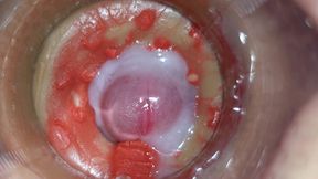 camera inside deep pussy captures huge ejaculation of sperm 4k