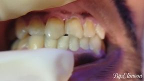 Showing you my "patient's" dirty teeth, role play pretending to be a dentist! (Close-up)