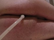 Retention Enema and Release 02