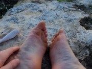 My feet after hiking - Part 2
