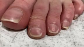 LONG TOES AND TOENAILS - HD