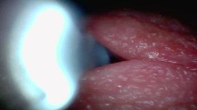 Endoscope camera captures moment of male ejaculation