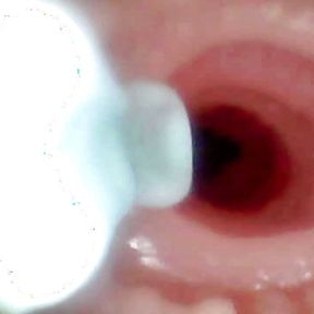 A detailed examination of Lopuza93 oral cavity and anal area using an endoscope camera.