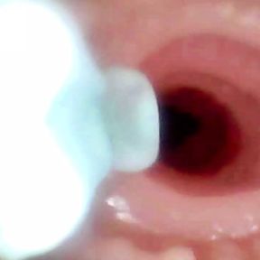 A detailed examination of Lopuza93 oral cavity and anal area using an endoscope camera.