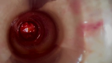 Flintstone's Dilemma Episode 2