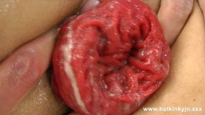 Rough Fisting Leads to Gaping Hole &mdash;  Shattered Dreams &mdash;  and Unraveling Rectal Trauma &mdash;  Oh So Sweet
