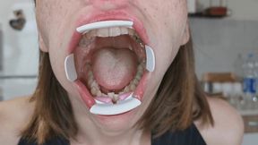 Alanna has a giant mouth-wmv