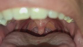 The beauty of my uvula