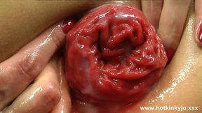 Double Stuffed Anus Orgy