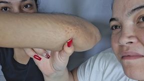 teeth on skin