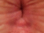 Zoom Into Asshole