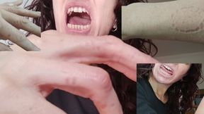 Angry biting my long fingers